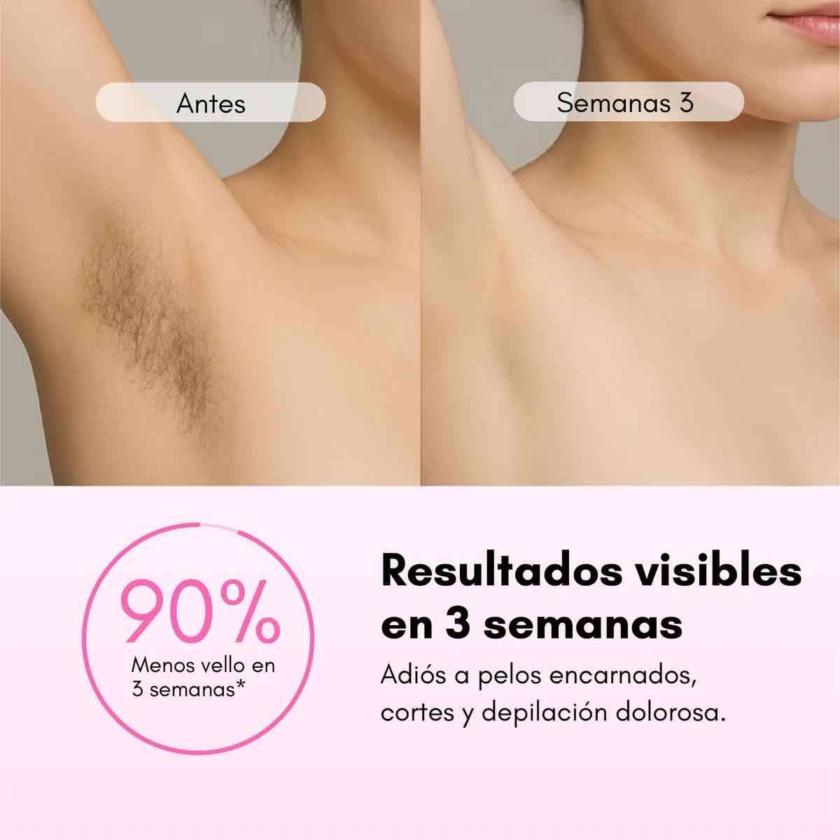 Depiladora láser RebelSkin - miniatura 4