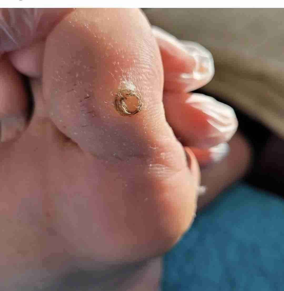 Podologia a Domicilio - 2