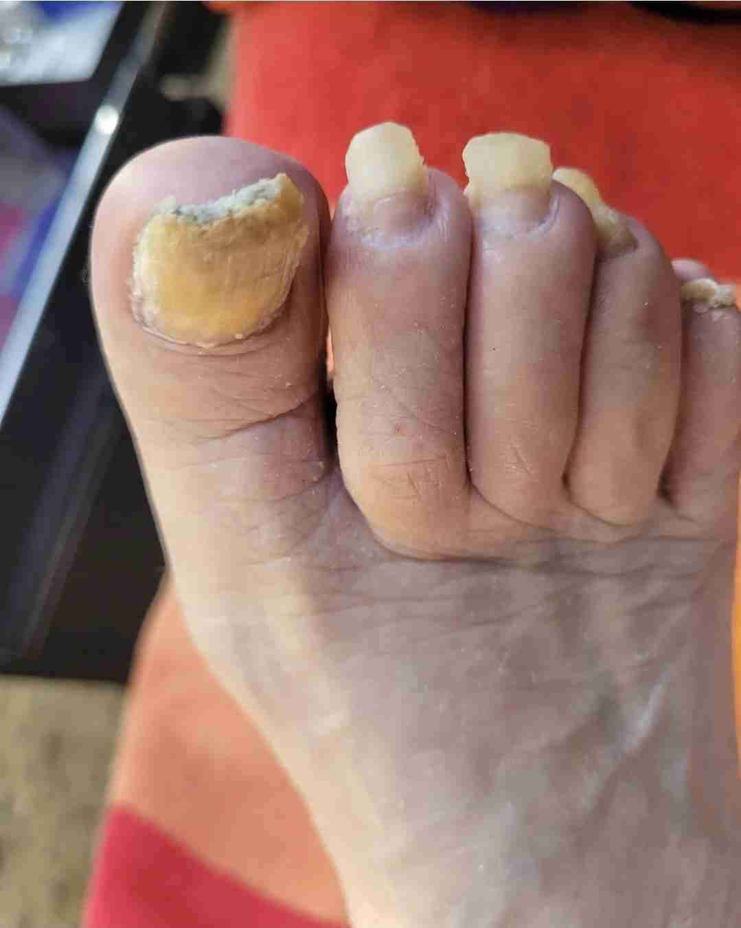 Podologia a Domicilio - 3