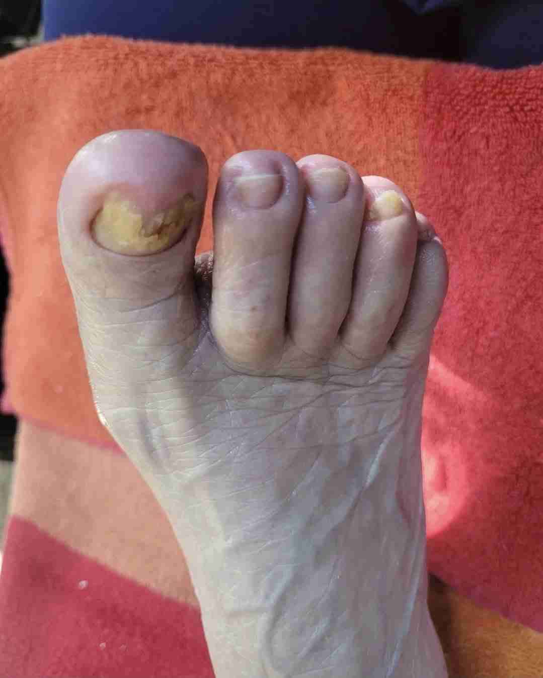 Podologia a Domicilio - 4