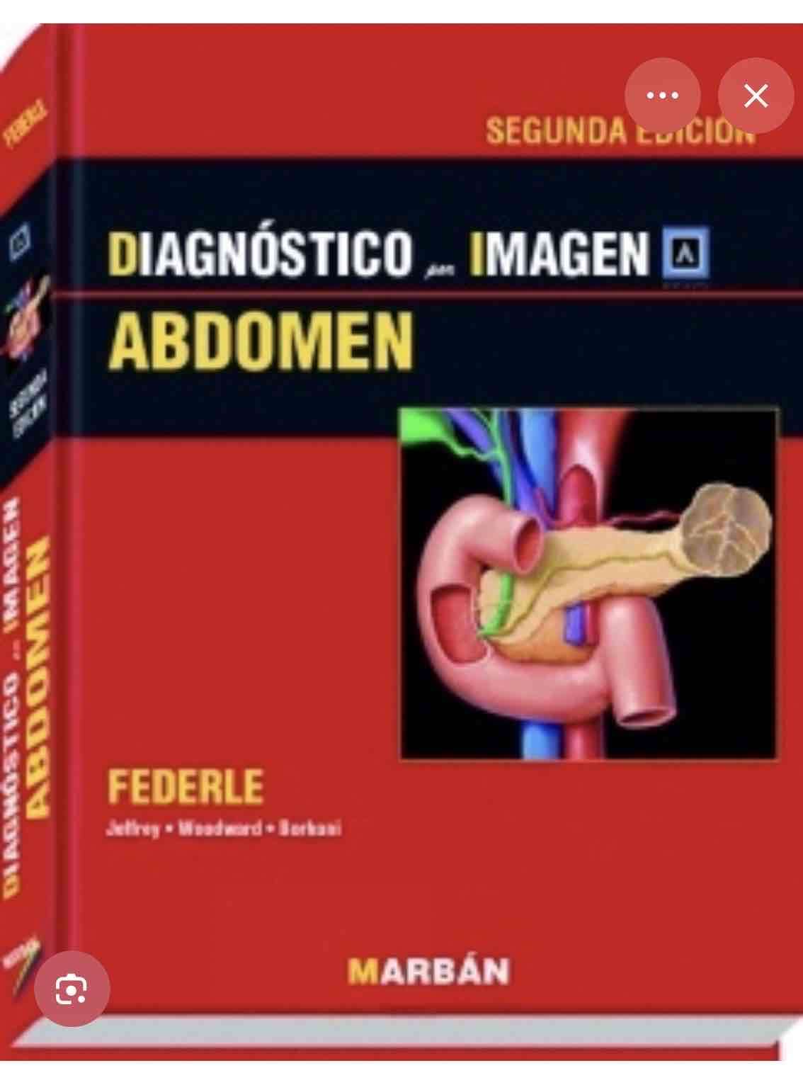 Libro Diagnóstico por Imagen Abdomen - miniatura 2
