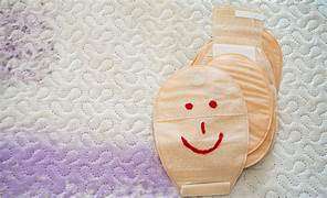 Manejo, Cuidado y Educación para  Ostomizados