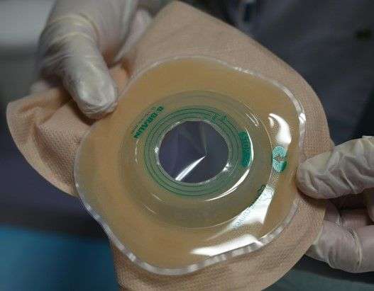 Manejo, Cuidado y Educación para Ostomizados - 4