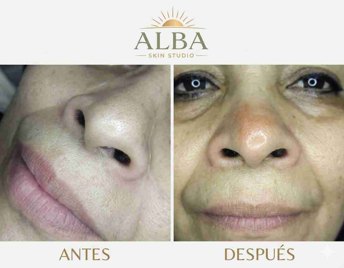 Servicios de estética facial y corporal - 2