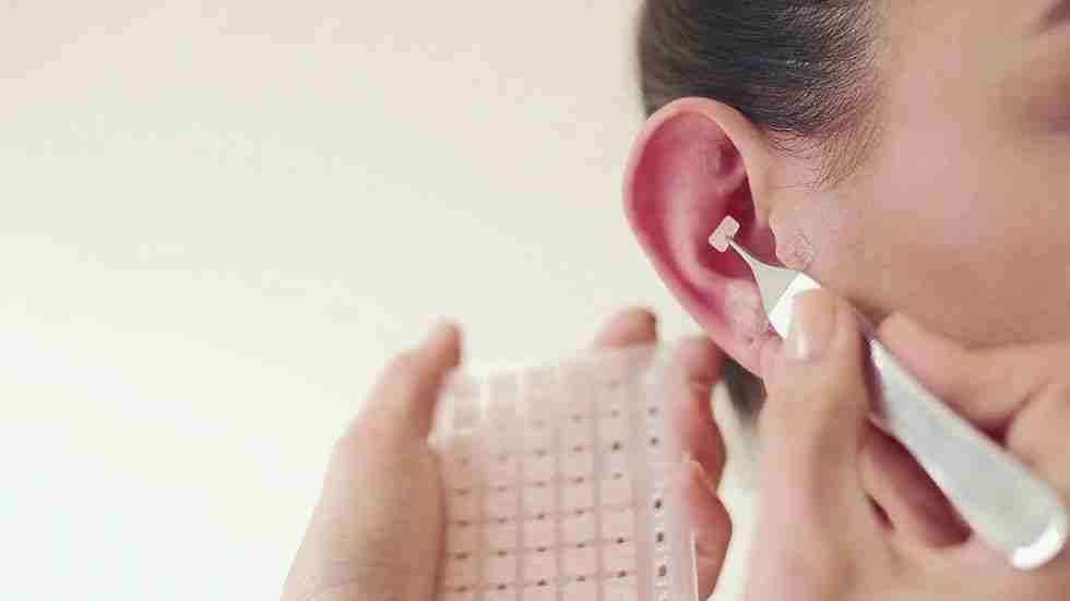 Auriculoterapia