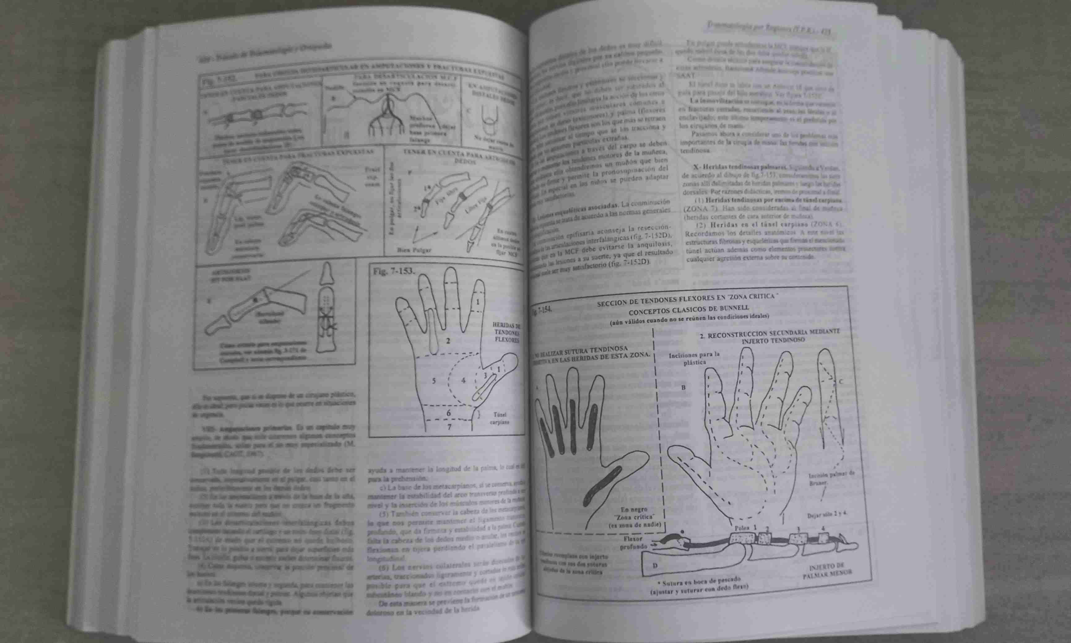 Libro Traumatología y Ortopedia - miniatura 4