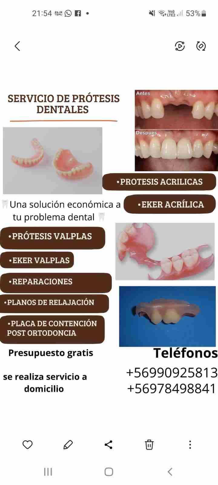 Servicios de prótesis dentales a domicilio - miniatura 1