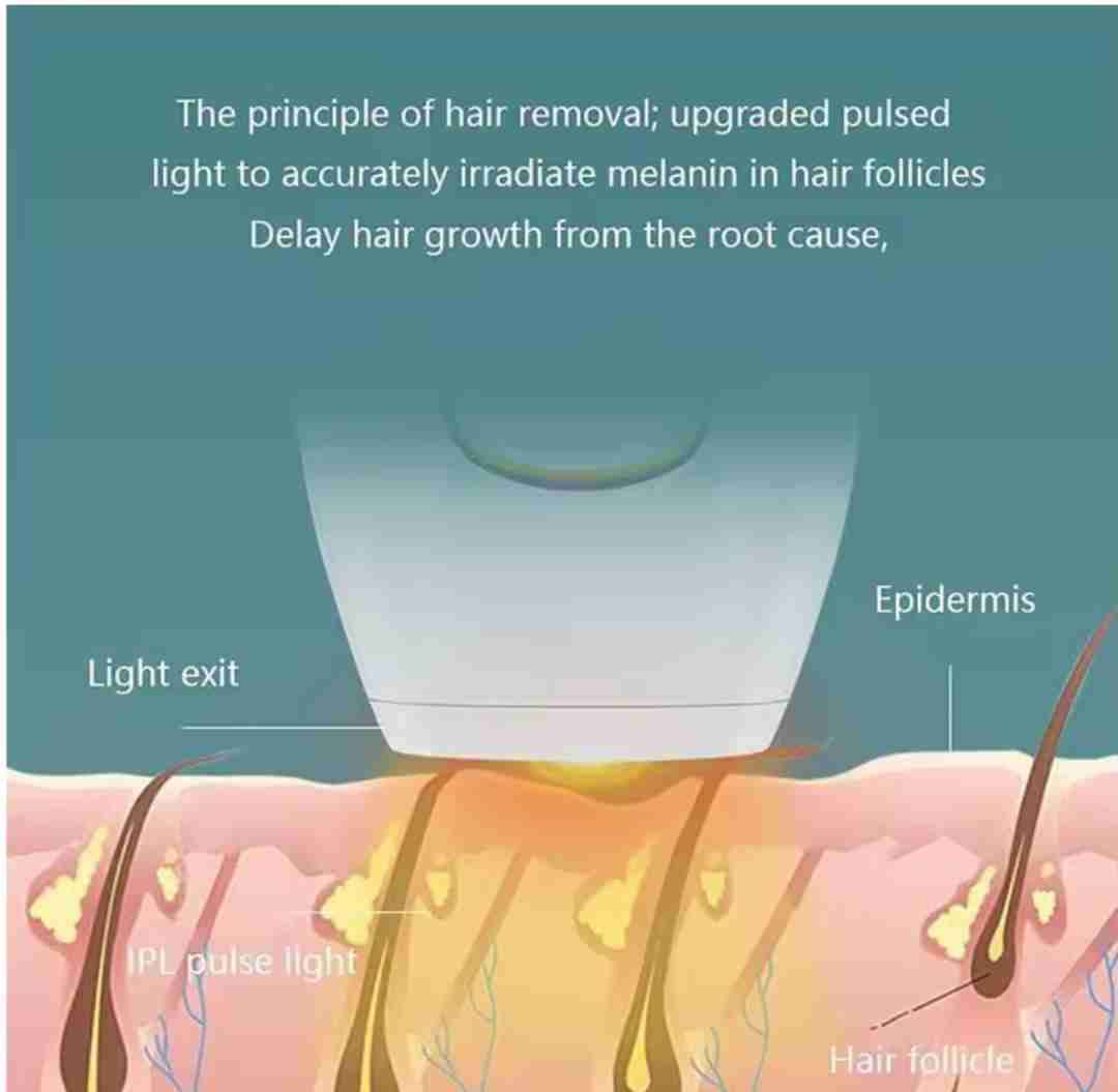 Depiladora IPL luz pulsada - 3
