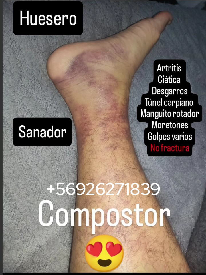 Servicio de Compostura, Huesero, compositor - miniatura 2