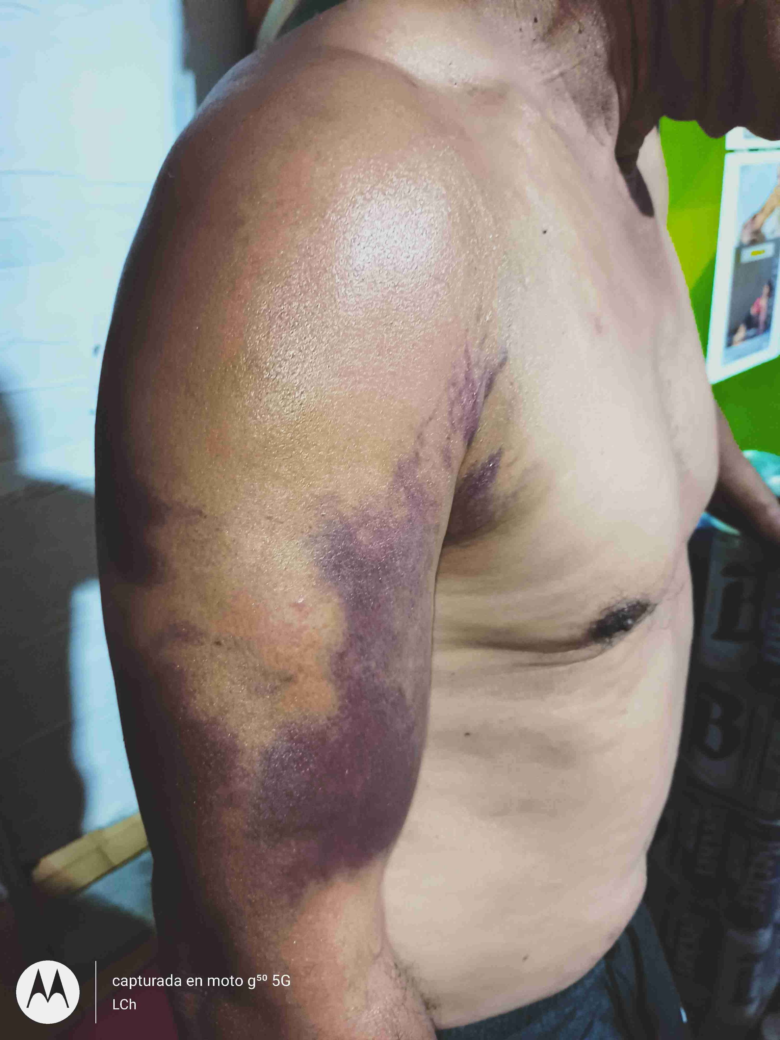 Servicio de Compostura, Huesero, compositor - miniatura 4