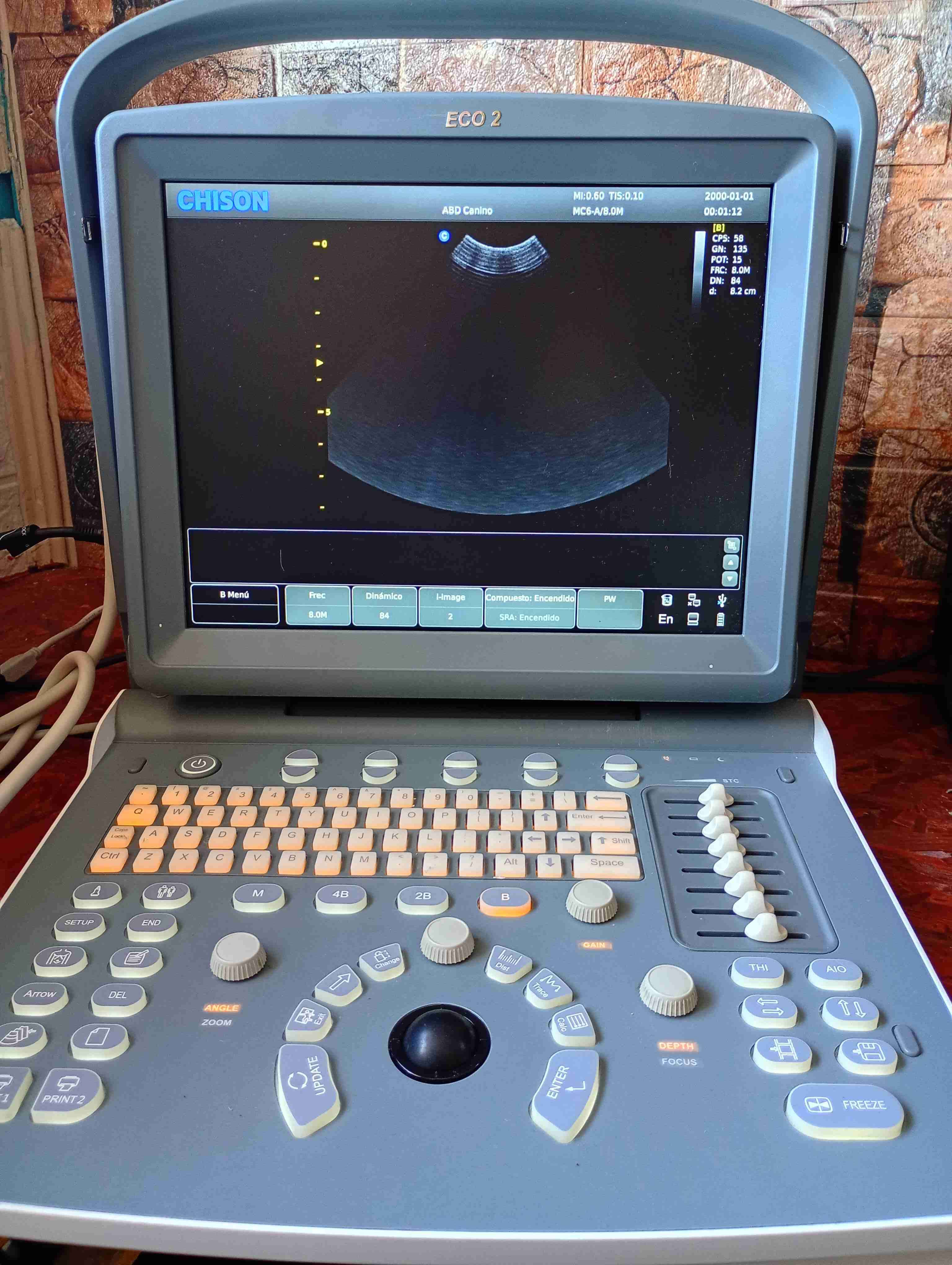 Ecógrafo portátil CHISON - miniatura 5