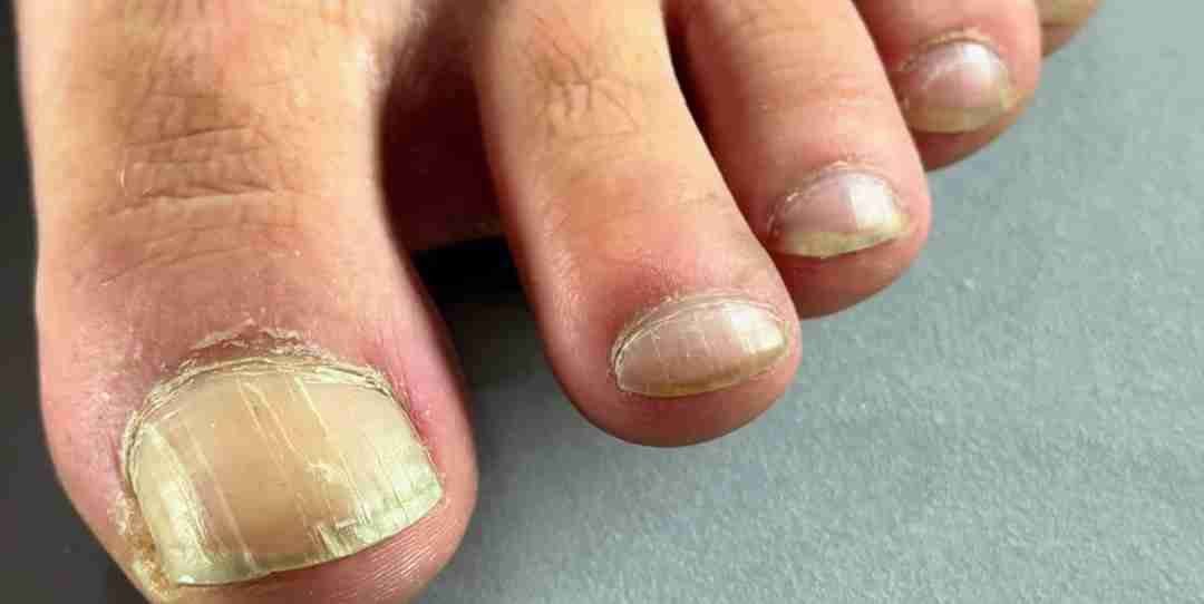 Servicio de podología a domicilió - 2