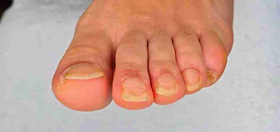 Servicio de podología a domicilió - 3