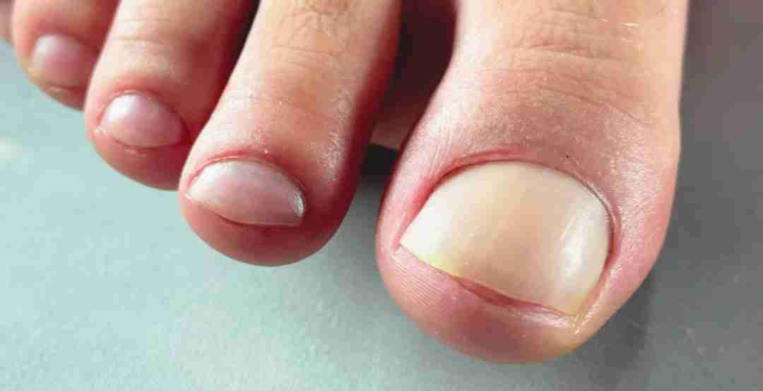 Servicio de podología a domicilió - 4