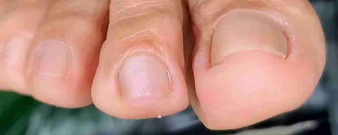 Servicio de podología a domicilió - 5