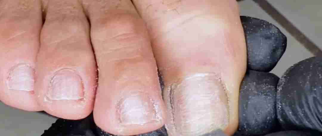 Servicio de podología a domicilió - 6