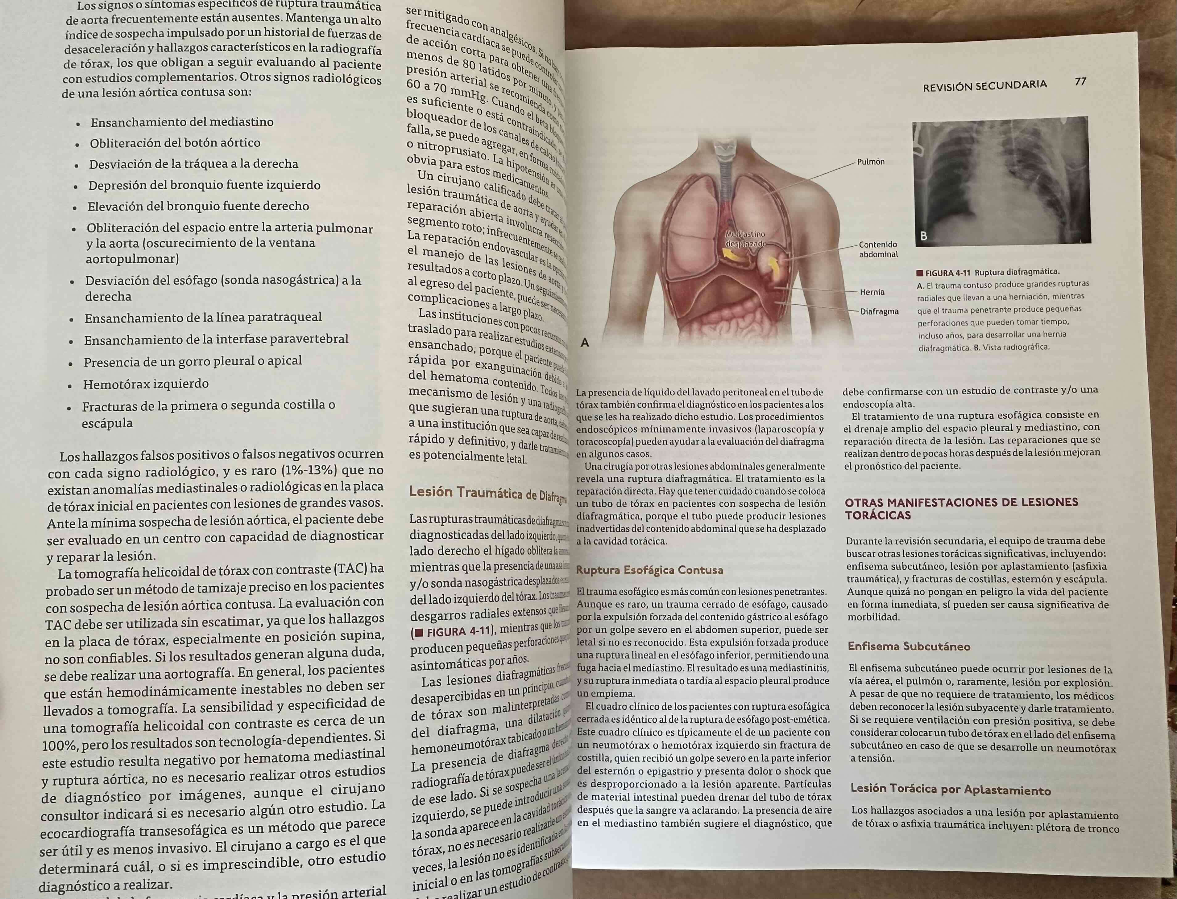 Libro ATLS Décima Edición - miniatura 4