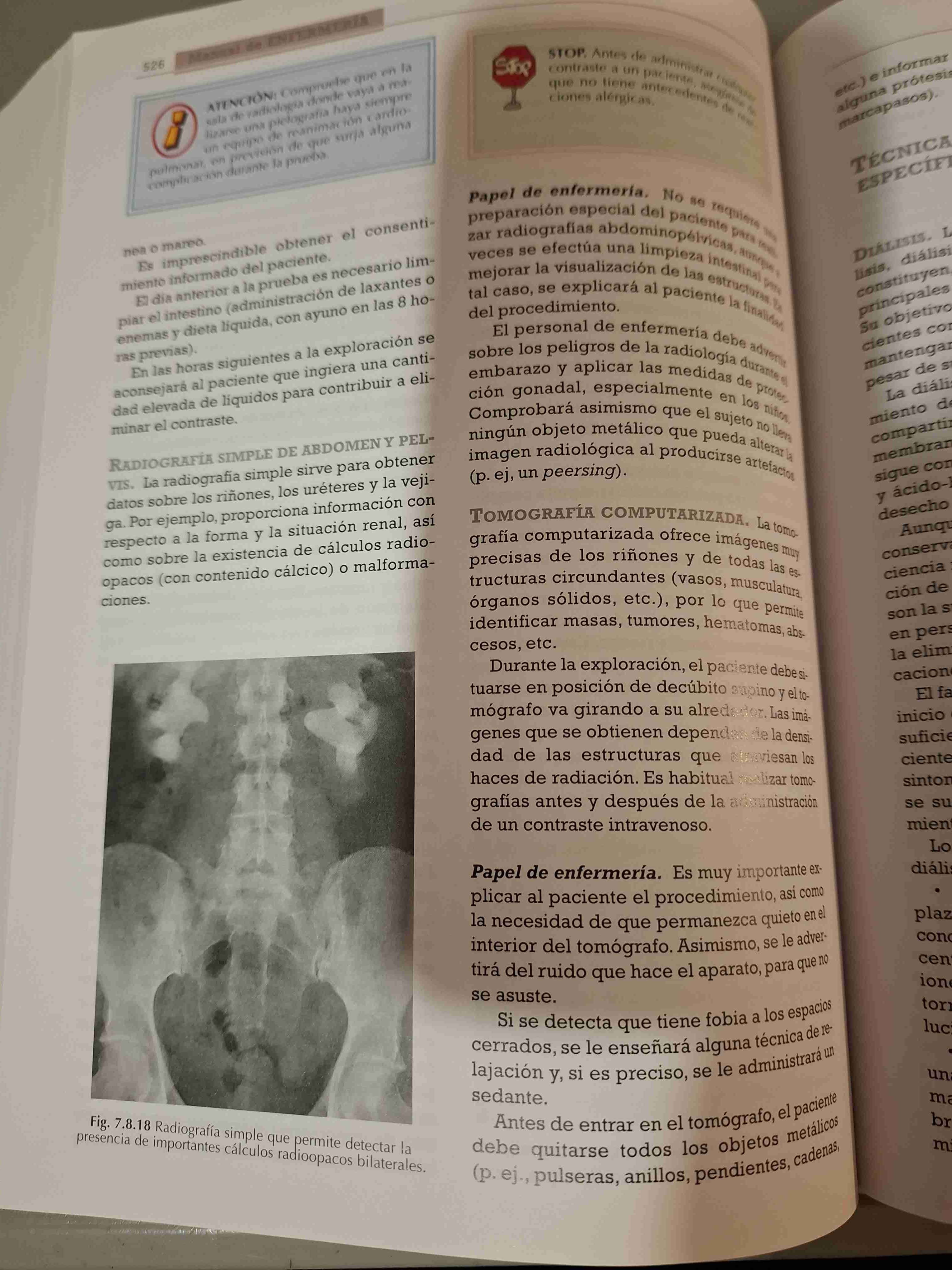 Manual de Enfermería Lexus - miniatura 5