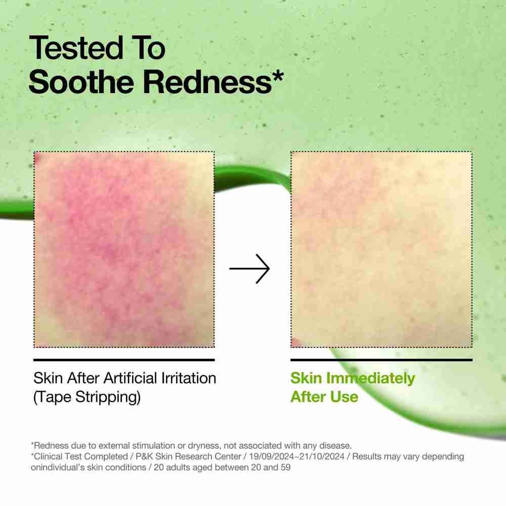 Sérum calmante anua 10+ ácido azelaico - miniatura 4