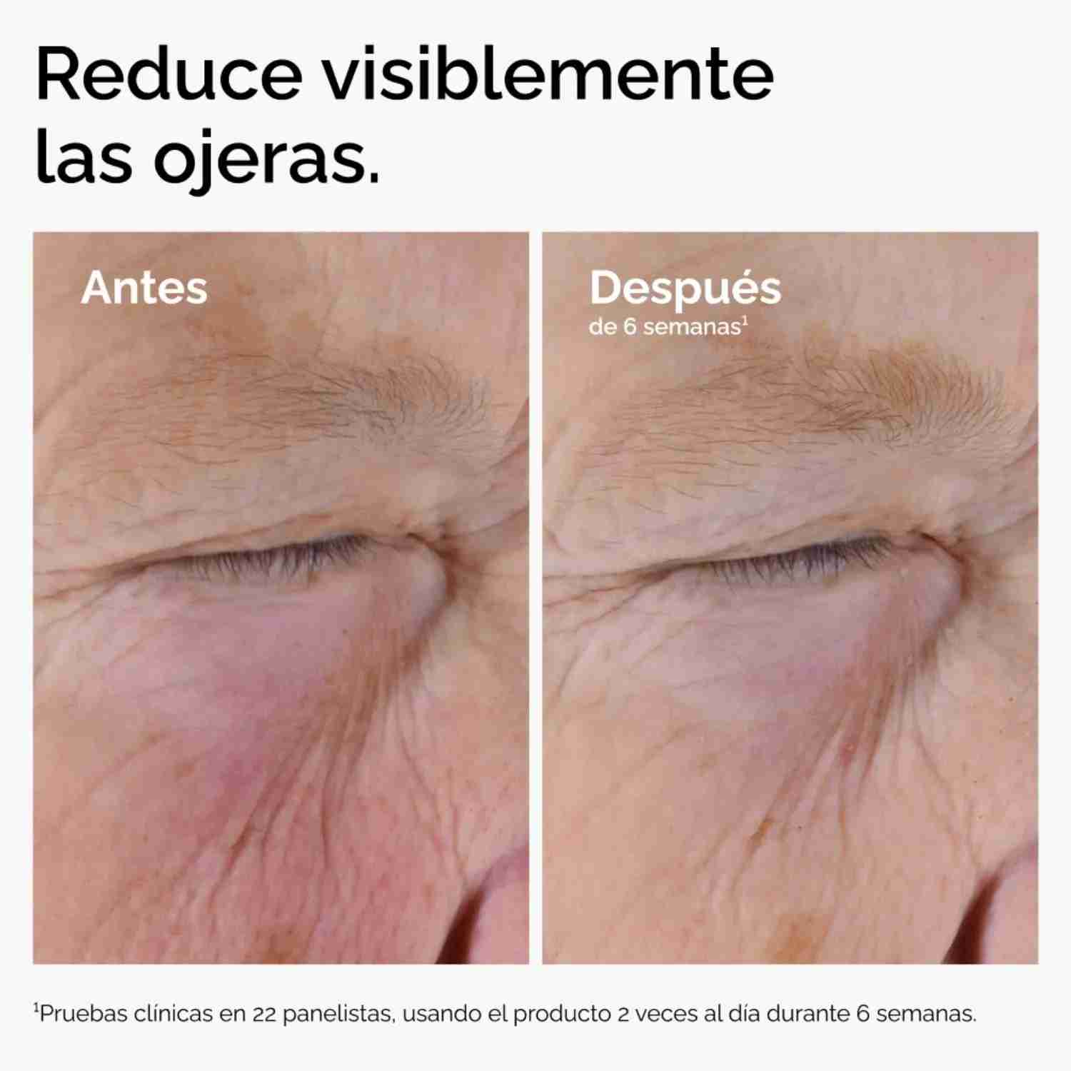 Solución Cafeína The Ordinary 30ml - miniatura 2