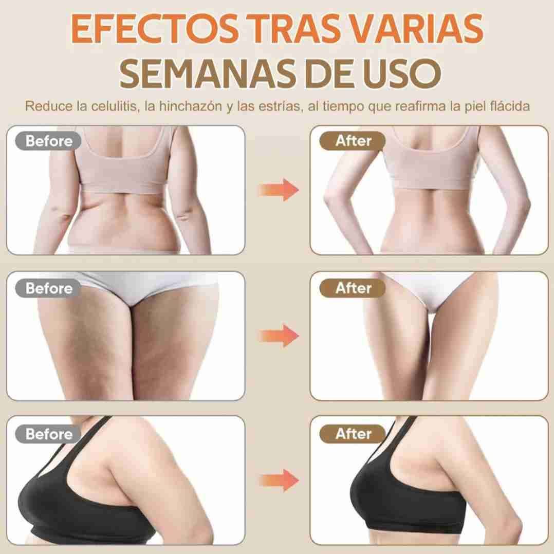 Masajeador eléctrico corporal de ventosa - miniatura 2