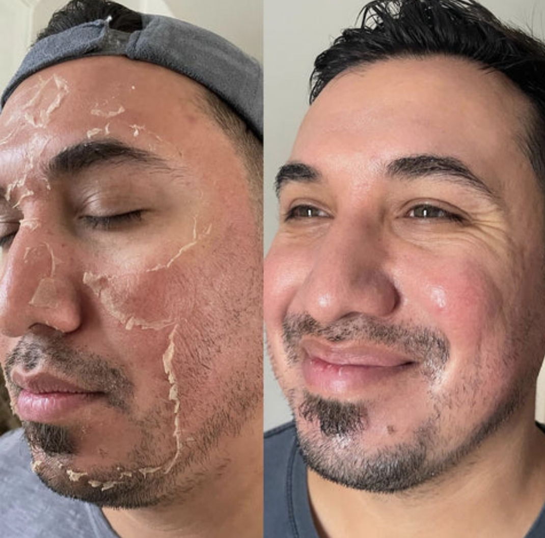 Kit cuidado facial Spongilla y Mascarilla - miniatura 2