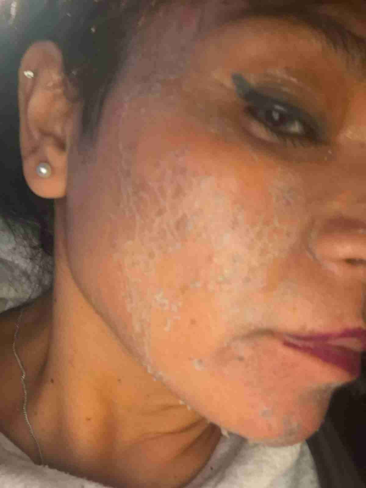Kit cuidado facial Spongilla y Mascarilla - miniatura 4