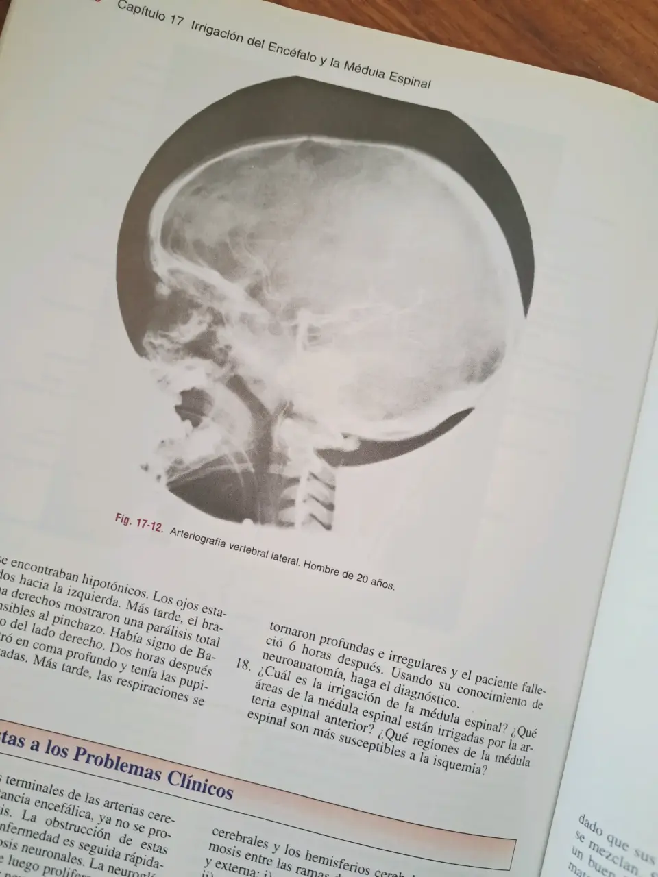 Libro Snell  Neuroanatomía Clínica 5ª Edición - miniatura 5