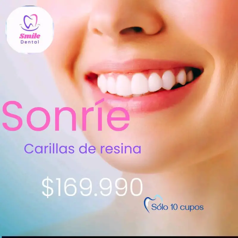 Carillas de resina dental