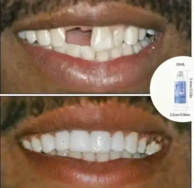 Dientes falsos moldeables para disfraz - miniatura 3