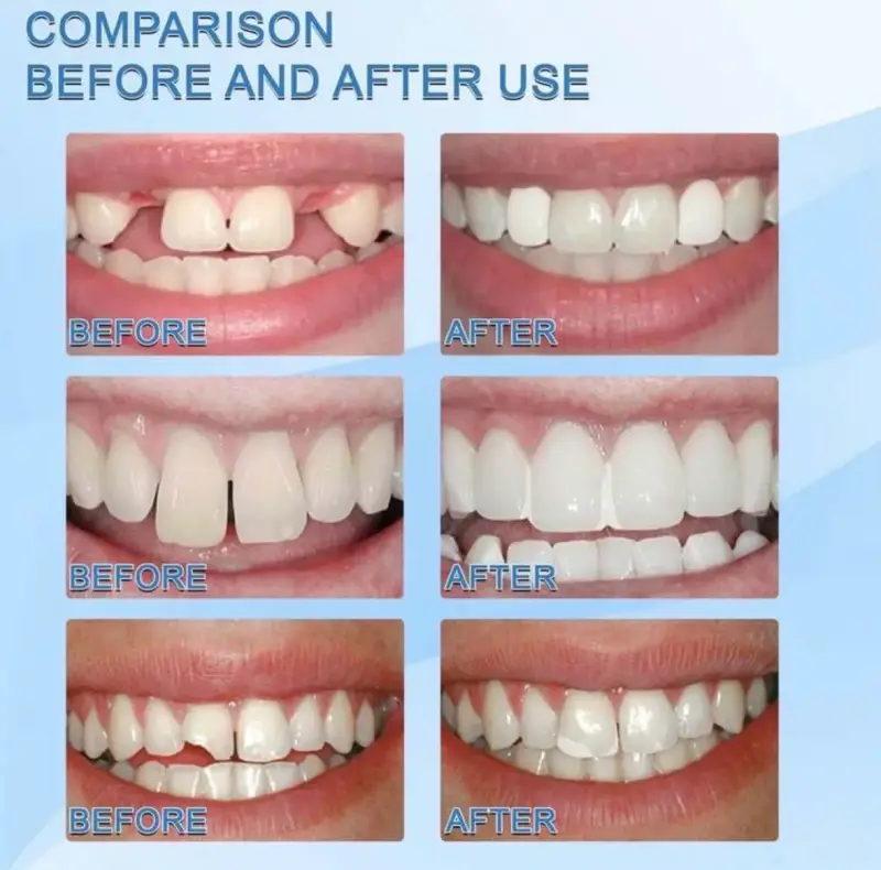 Dientes falsos moldeables para disfraz - 4
