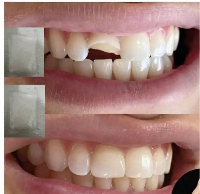 Dientes falsos moldeables para disfraz - 5