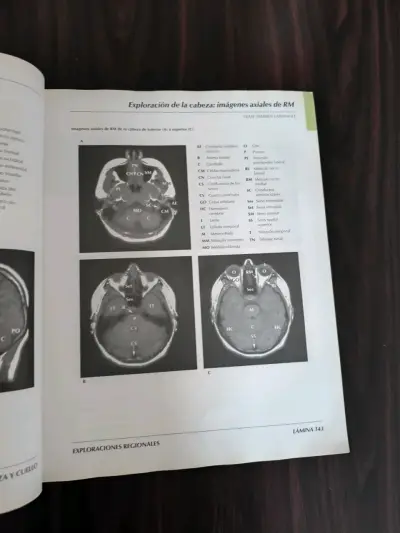 Atlas de Anatomía Humana 3ª edición - miniatura 6