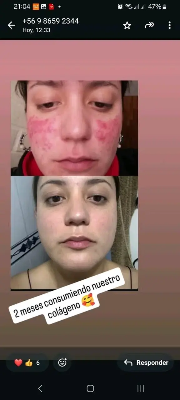 Suplemento Renöva+ antioxidante - 3
