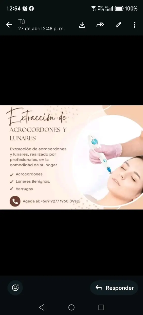Extraccion acrocordones y verrugas - 1