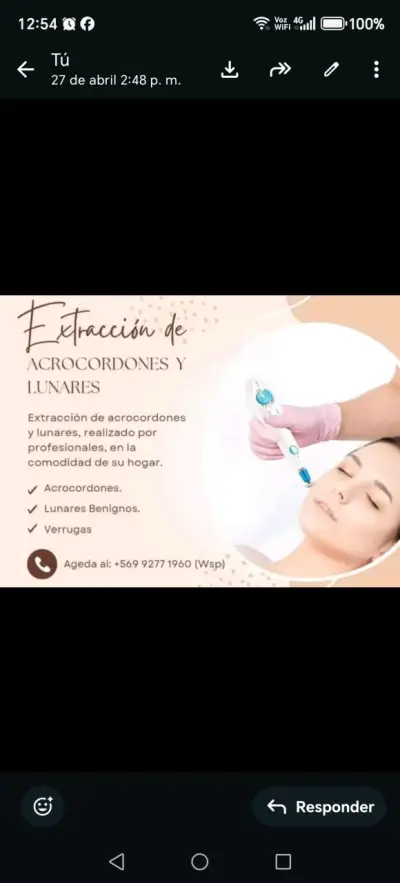 Extraccion acrocordones y verrugas - miniatura 1