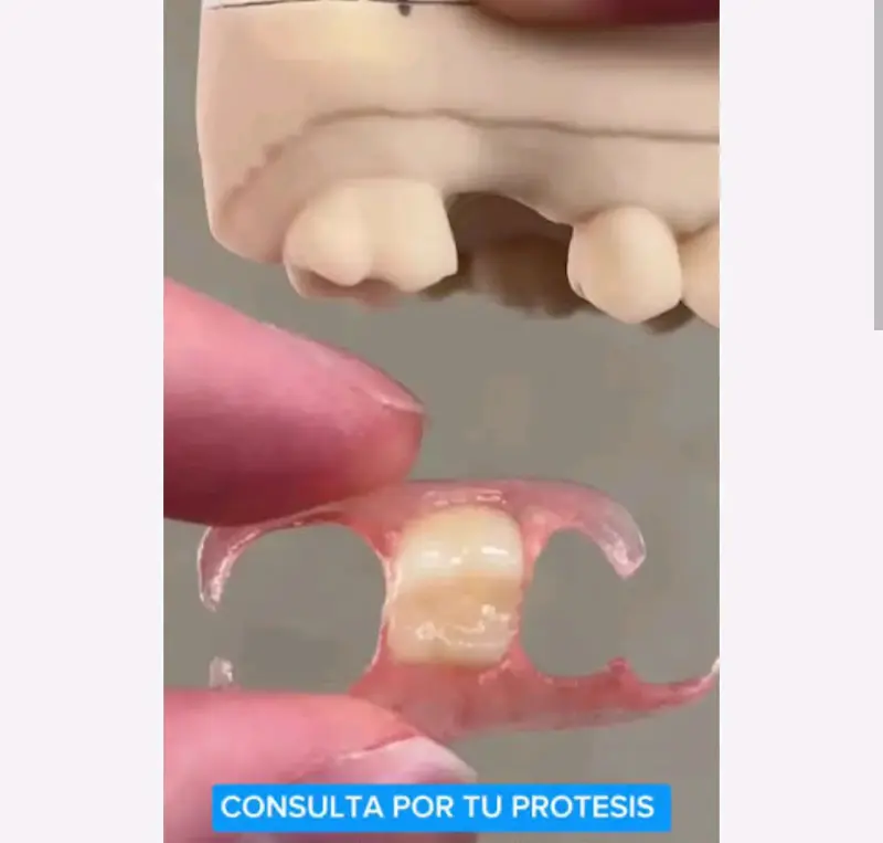 Prótesis dentales hacemos envios - 3