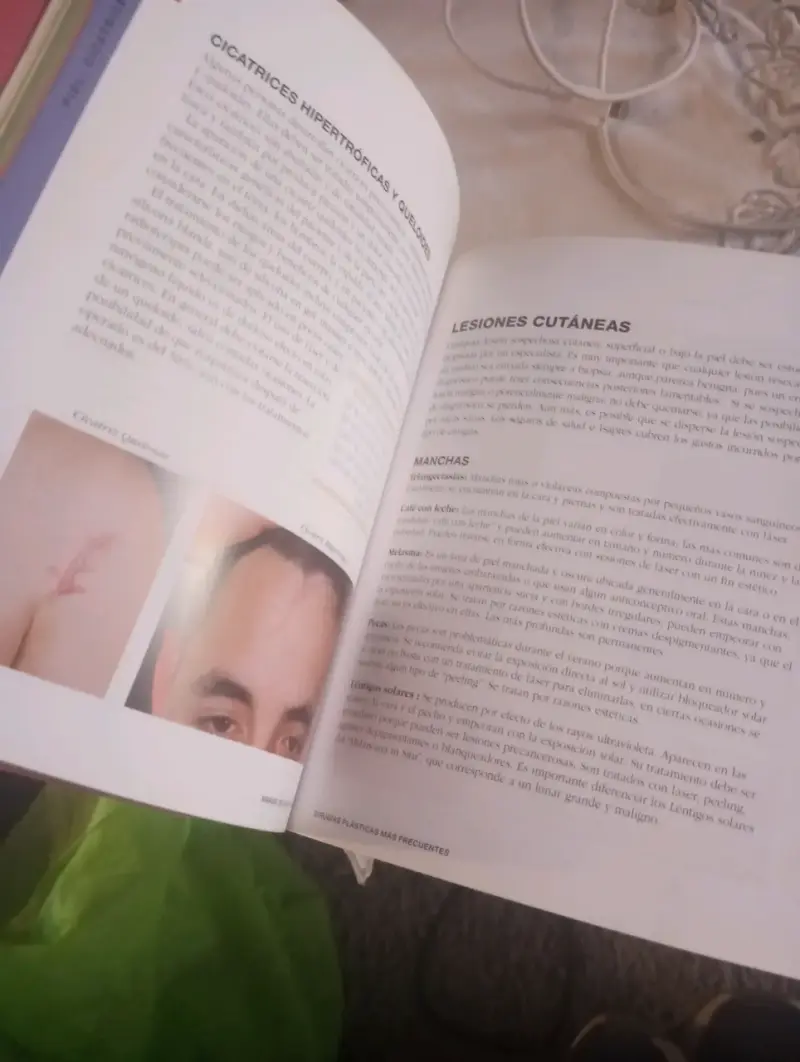 Libro Manual de Cirugía Plástica - Dr. Pedro Vidal - 3