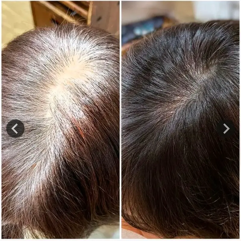 Shampoo Tinte Negro,Castaño Claro, Castaño Oscuro - 3
