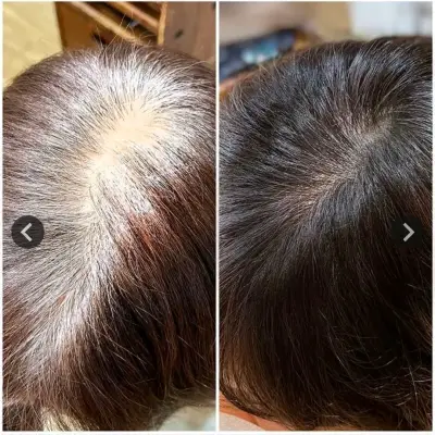 Shampoo Tinte Negro,Castaño Claro, Castaño Oscuro - miniatura 3