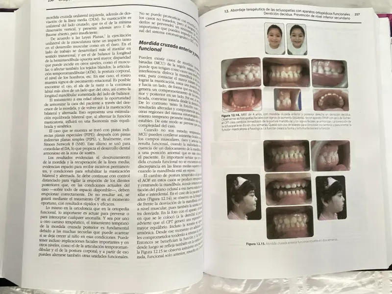 Libro Ortopedia Funcional Maxilares Copia - 2