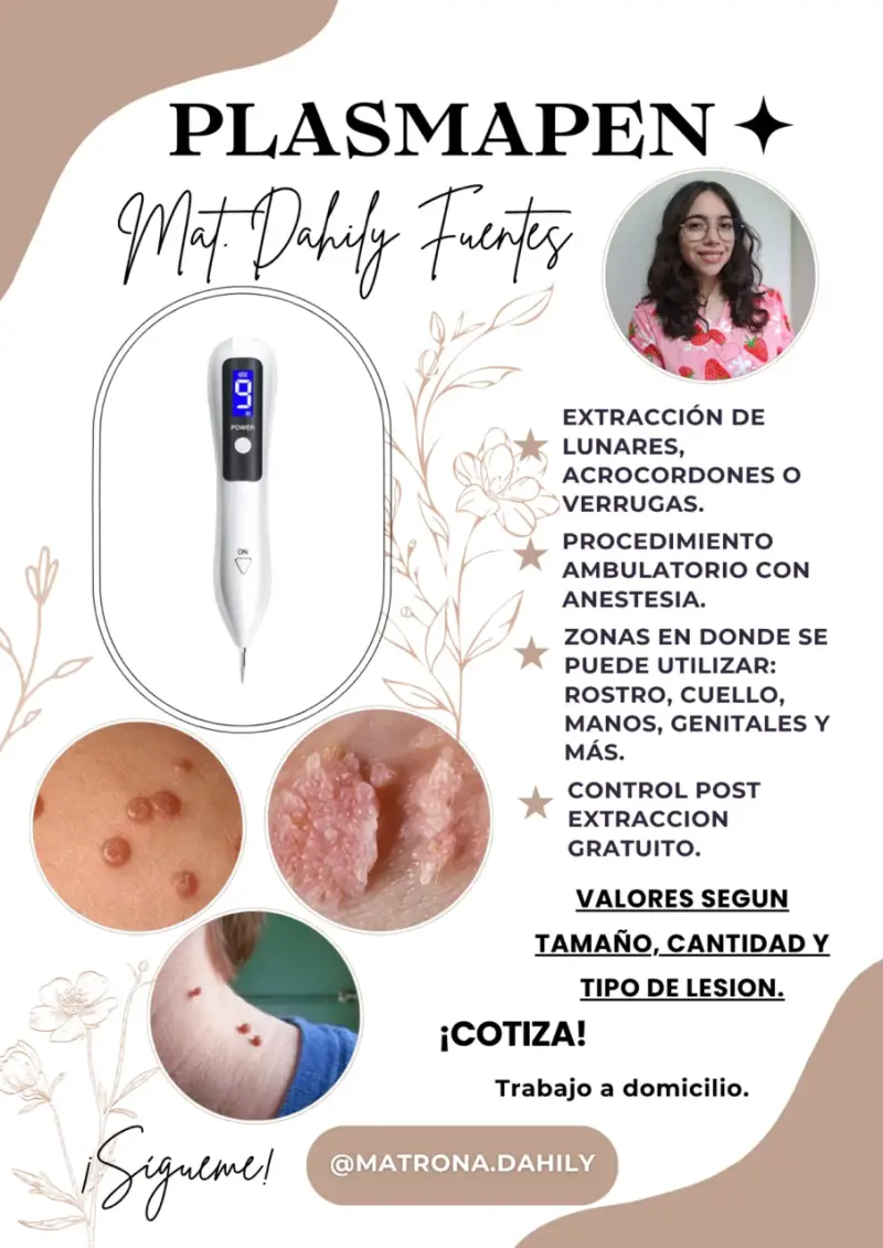 Plasmapen para extracciones