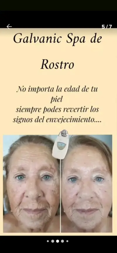 Galvánica facial impecable - miniatura 4