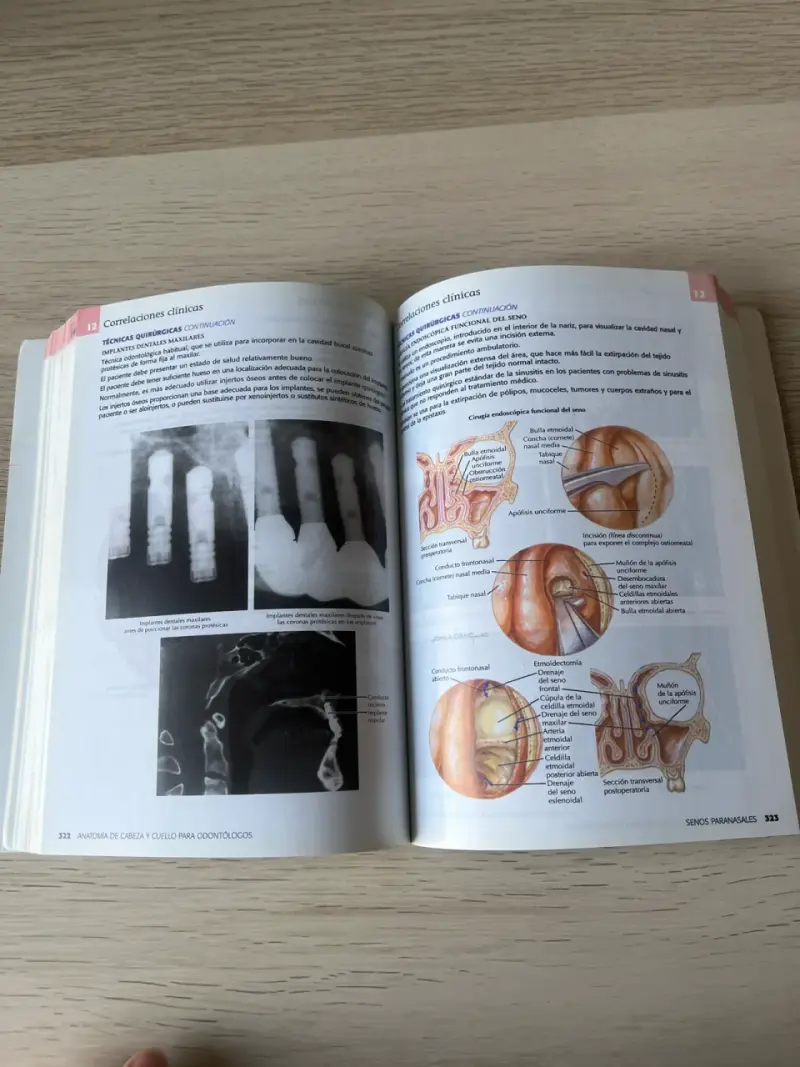 Libro Netter Anatomía de Cabeza y Cuello - 3