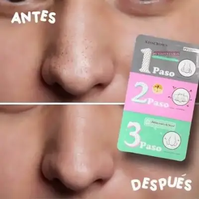 KIT HANKEY PARA PUNTOS NEGROS DE 3 PASOS - miniatura 6