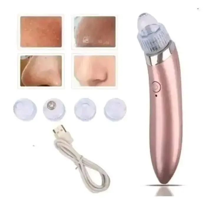 Extractor puntos negros - 3