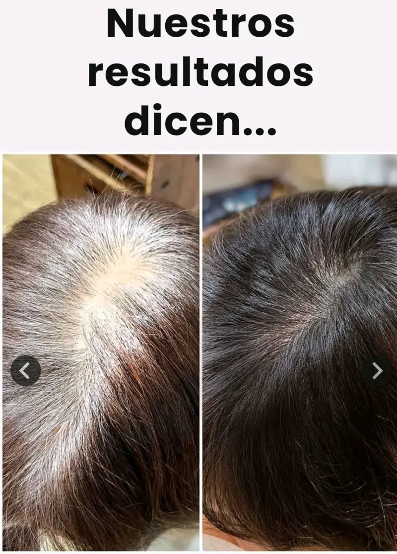 Shampoo cubre canas en oferta a solo 14,990 as - 2