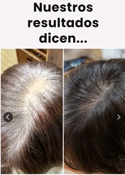 Shampoo  cubre canas en oferta a solo 14,990 as - miniatura 2