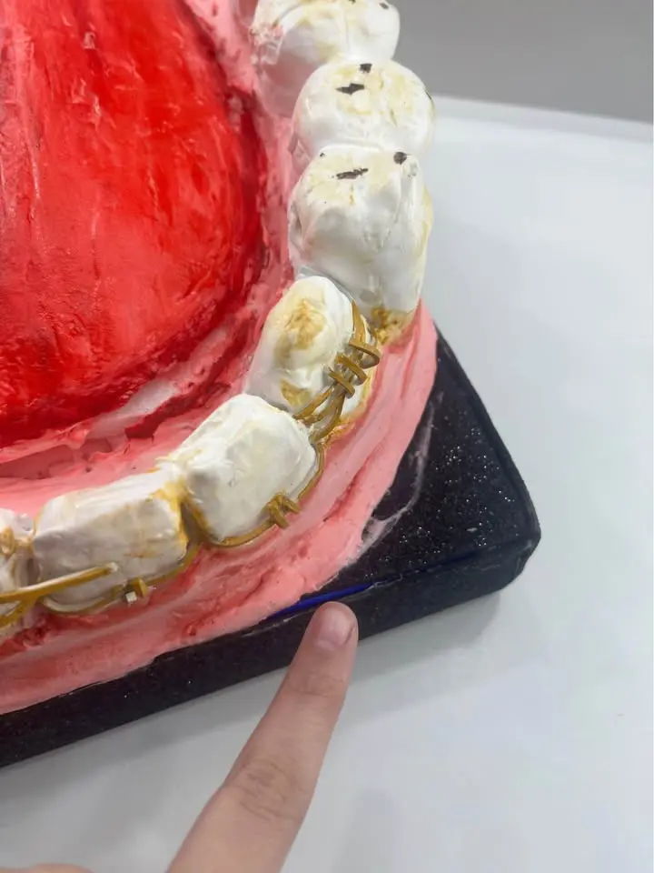 Maqueta de Dientes fenicios - 3