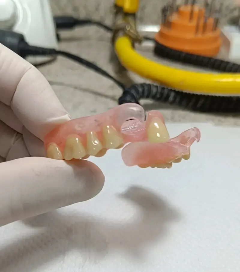 Prótesis Dentales Removibles Maipú - 2